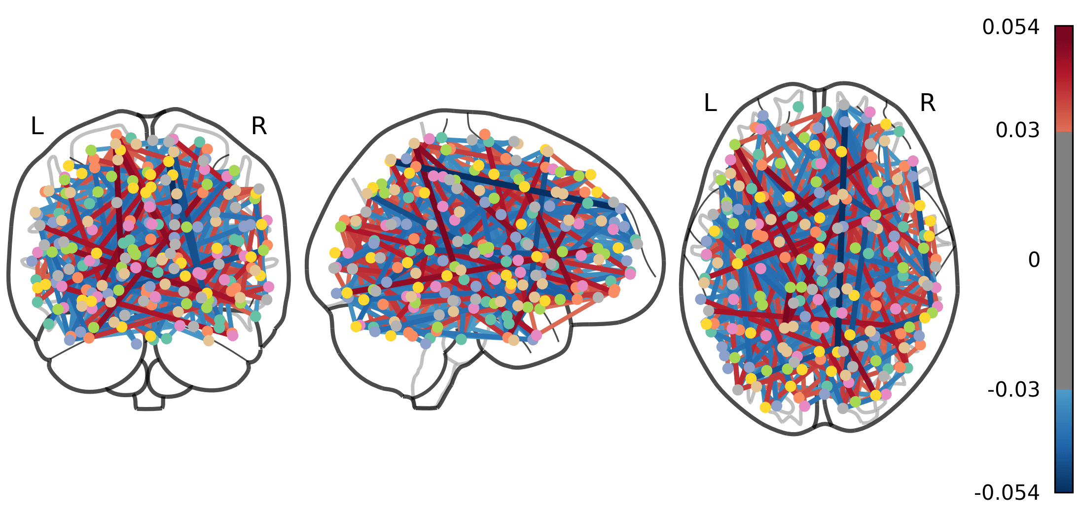 Brain connectome showing influential functional connections